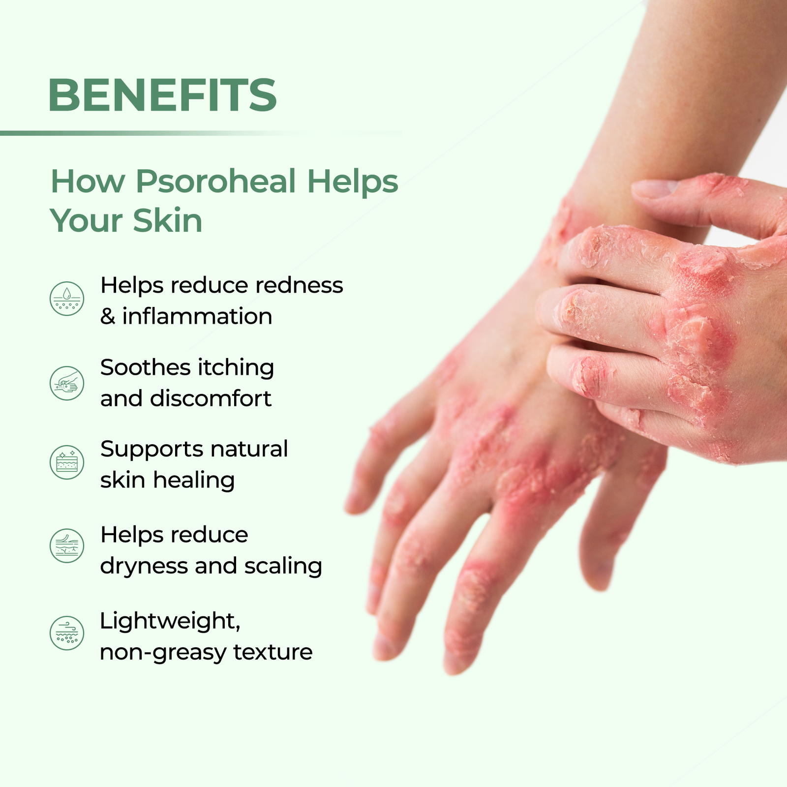 Dewdrop F5 Dewdrop F5